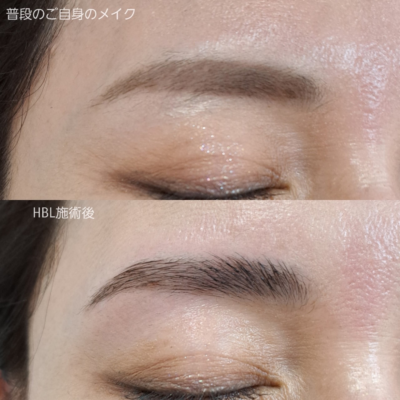 ハリウッドブロウリフトビフォーアフター